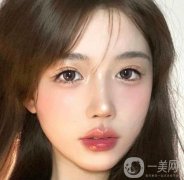 嘟嘟唇整容怎么樣?唇部整容有什么風(fēng)險(xiǎn)?