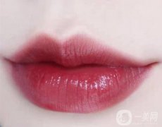 m型唇部整形手術(shù)方法有哪些?