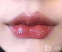 你知道哪些豐唇珠的危害?做完之后應(yīng)該怎么打理?