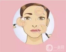 哪些部位可以電波拉皮？