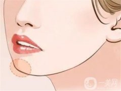 有哪些豐下巴的方法？