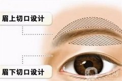 有哪些切眉方式？