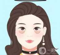 眼袋有哪些類型，去眼袋有什么優(yōu)勢？