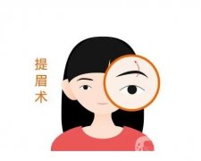 提眉手術(shù)有哪些特征