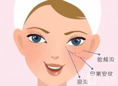 膠原蛋白填充淚溝果好不好？填充前后需要注意什么