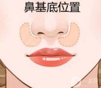 如何填充鼻基底凹陷才不會老？
