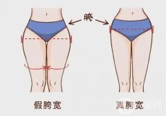 假胯寬可以減掉嗎？具體都有哪些方法呢？