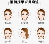 電波拉皮是什么？作用與價(jià)格？