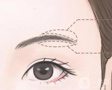 切眉有什么作用和副作用？