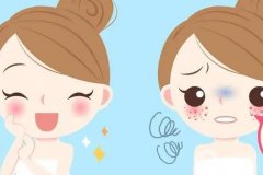 祛痣有什么風(fēng)險嗎？哪種祛痣方法好？