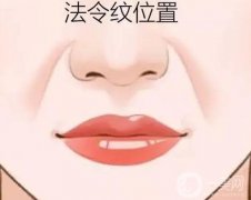 用脂肪填充法令紋能管多久？果如何？