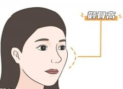 降低顴弓和顴骨內推有什么不同？