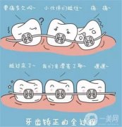 矯正牙齒感覺怎么樣？矯正牙齒有年齡限制嗎？