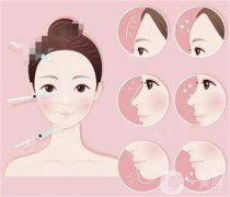 脂肪填充大的腫脹是哪一天？