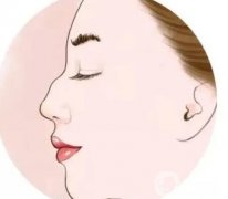 駝峰鼻矯正多久能恢復(fù)？需要注意什么？