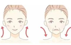 面部提升適合什么年齡？有什么優(yōu)勢(shì)？