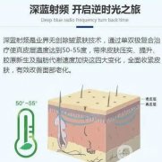 深藍射頻果能持續(xù)多久？副作用是什么？