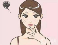 哪些斑適合激光調(diào)節(jié)？怎么選擇不同的激光調(diào)節(jié)？