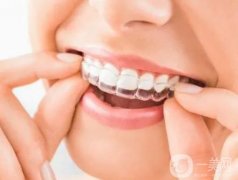 隱適美隱形矯正有哪些利與弊