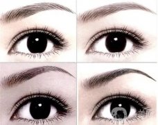 激光洗眉會(huì)出血嗎？洗眉毛不出血的激光儀有哪些？