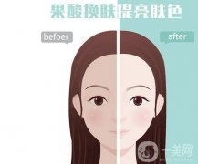 果酸換膚的果可以維持多久？有哪些癥狀適用于果酸換膚？