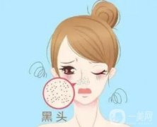 果酸換膚去黑頭的果怎么樣呢？有哪些醫(yī)美項目可以改良黑頭？