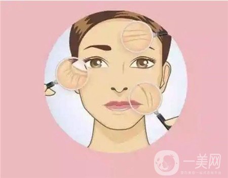 熱瑪吉電波拉皮*果怎么樣？維持多久？