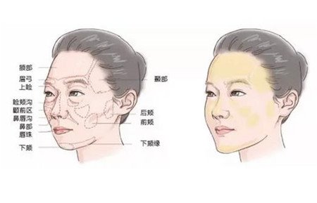 臉部自體脂肪填充價格一般是多少？*果好不好？