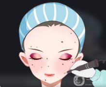 激光點(diǎn)痣后不能吃什么？可以吃辣椒嗎？