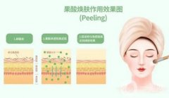 果酸換膚前后需要注意什么？這幾點(diǎn)一定要注意
