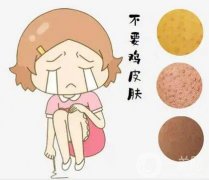 雞皮可以用激光去除嗎？具體有哪些注意事項呢？