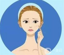 哪些因素影響激光祛斑的價格？多少錢一個療程？