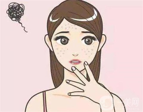 去老年斑的方法都有哪些呢 哪種比較好？