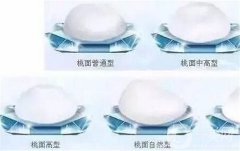 隆胸假體取出來后胸部會是什么樣的？