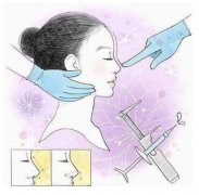 延長(zhǎng)鼻小柱可以用什么材料？有哪些手術(shù)方法？
