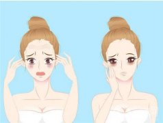 像素射頻除皺怎么樣？價格收費貴不貴？有后遺癥嗎