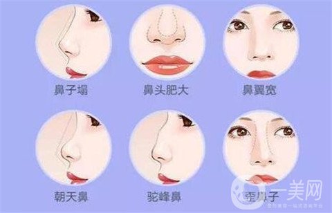 徐州二院整形美容科價(jià)格表，附隆鼻整形案例