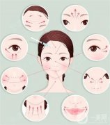 哪些皺紋可以手術(shù)去除？具體有哪些呢？