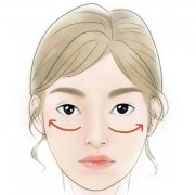 注射玻尿酸填充法令紋的價(jià)格受哪些因素影響?