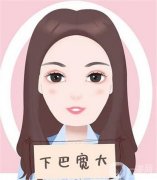 墊下巴多久可以側(cè)睡？恢復(fù)期是多久？