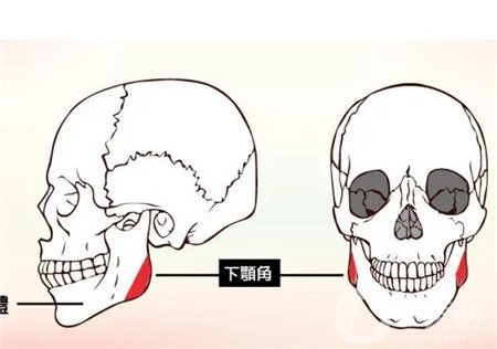 磨骨手術(shù)照片 磨骨*果怎么樣？