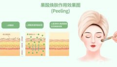 果酸換膚后怎么保養(yǎng)避免復發(fā)