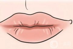 如何防止嘴唇出現(xiàn)皺紋？嘴唇上有皺紋是什么原因？