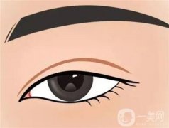 不同的人適合什么樣的雙眼皮？
