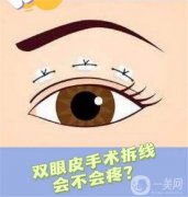雙眼皮什么時候做好？雙眼皮適合秋天做嗎?