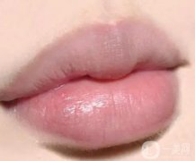 紋唇可能引發(fā)哪些危害？紋唇線有什么危害？