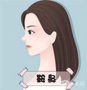 鞍鼻整形的材料有哪些？鞍鼻整形什么假體好？