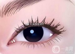不適合開眼角的人群？不適合開眼角的人群有哪些？