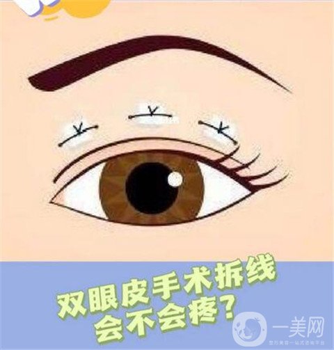寧波市第一醫(yī)院整形美容科割雙眼皮怎么樣？價(jià)格表及案例詳情