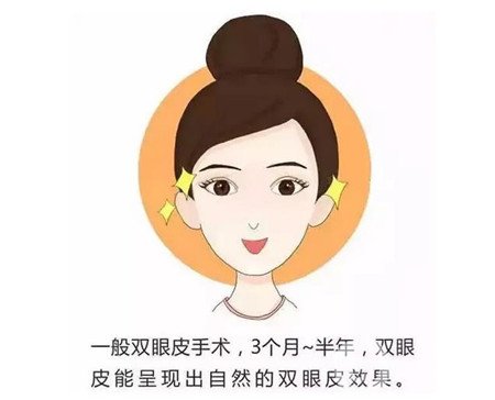 杭州格萊美醫(yī)院做雙眼皮咋樣?案例價格表公開